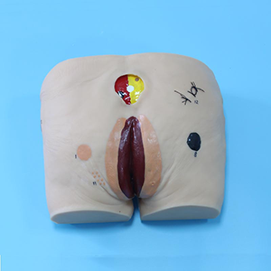 Pressure Ulcer_Depression Ulcer Nursing Model